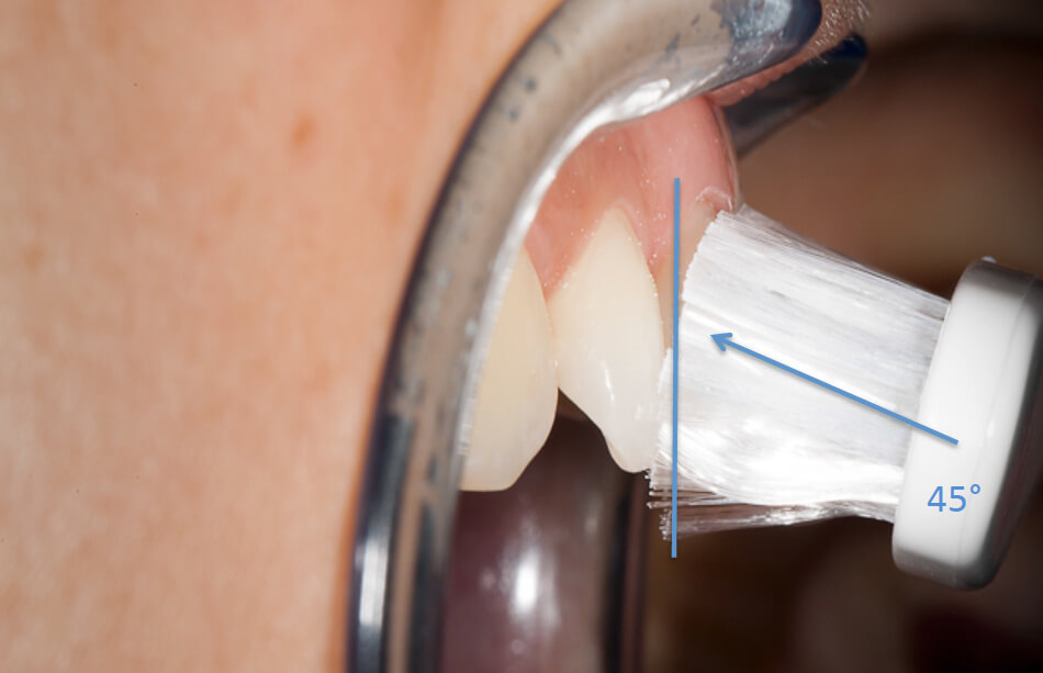Direclin - Dicas Higiene Oral 3