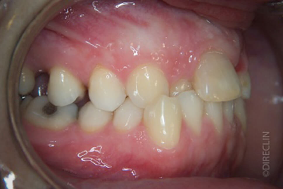 Direclin - Ortodontia e Implante 7