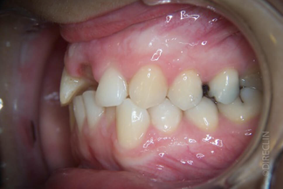 Direclin - Ortodontia e Implante 5
