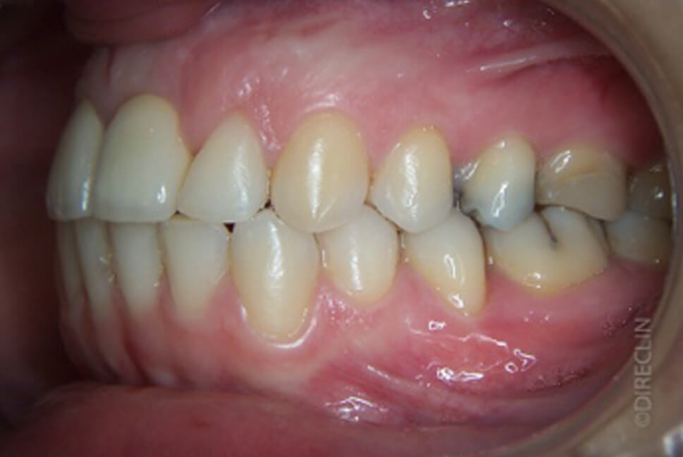 Direclin - Ortodontia e Implante 2