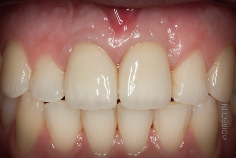 Direclin - Ortodontia e Implante 1