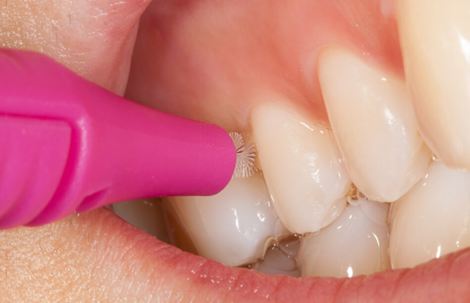 Direclin - Dicas Higiene Oral 8