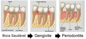 Parodontie, Chirurgie Orale et Implants Dentaires