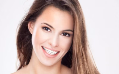 Tenho que usar Aparelho Dentário, e agora?