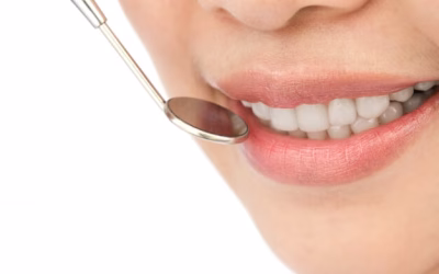 Como manter uma higiene oral exemplar