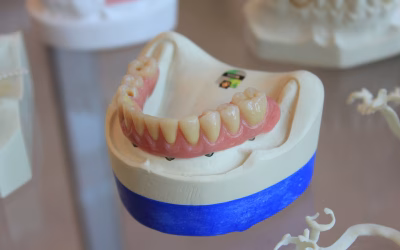 Que cuidados devemos ter com a prótese dentária?