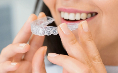 Alinhadores invisíveis: a solução discreta para alinhar o sorriso